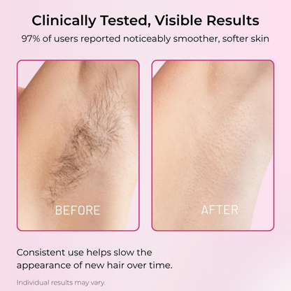 Advanced Hair Reduction Formula